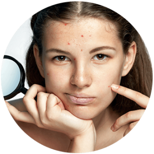 When Should I See a Dermatologist?