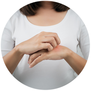 Eczema vs Psoriasis