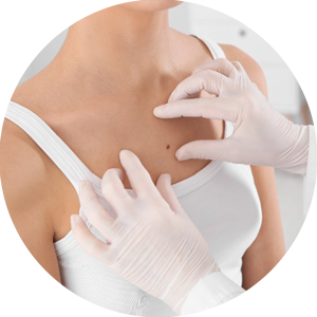 The ABCs of Skin Cancer